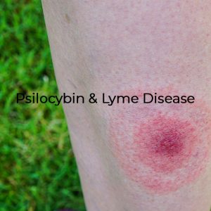 Psilocybin and Lyme Disease Study